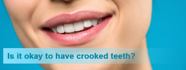 Is it okay to have crooked teeth