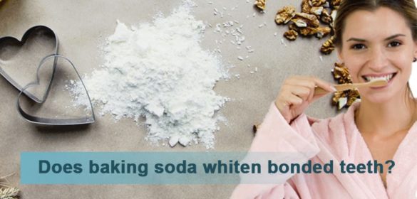 How to Whiten Bonded Teeth at Home - Life Cycle Blog