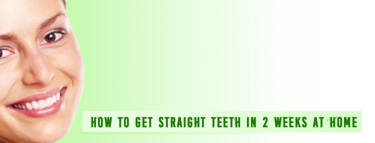 How to get straight teeth in 2 weeks at home