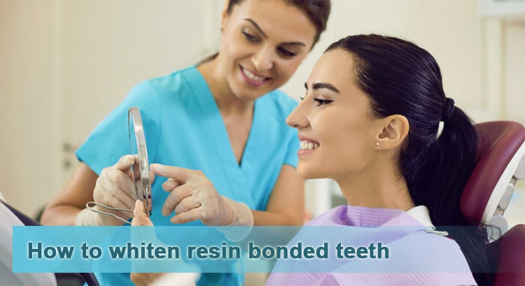How to whiten resin bonded teeth