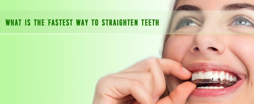 What is the fastest way to straighten teeth