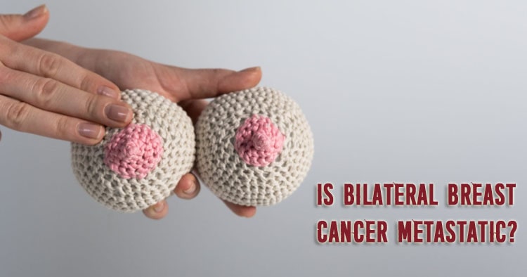 Bilateral Breast Cancer